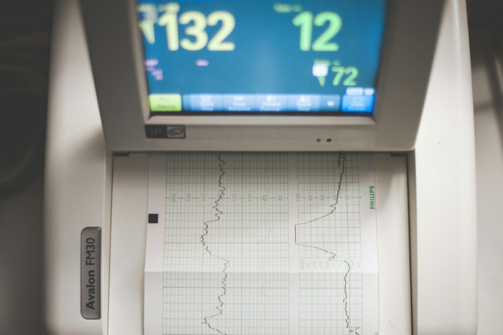 Medical monitor printing trend lines on chart paper, illustrating proactive monitoring of claim denial trends.